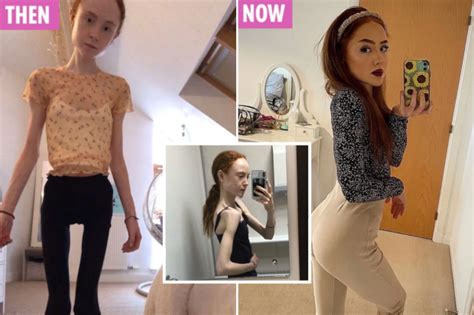 anorexic porn|Anorexic Porn Videos 